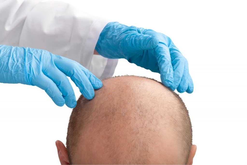 hair transplant turkey package